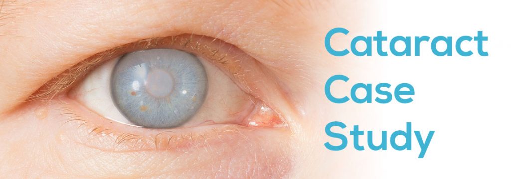 nursing case study cataract