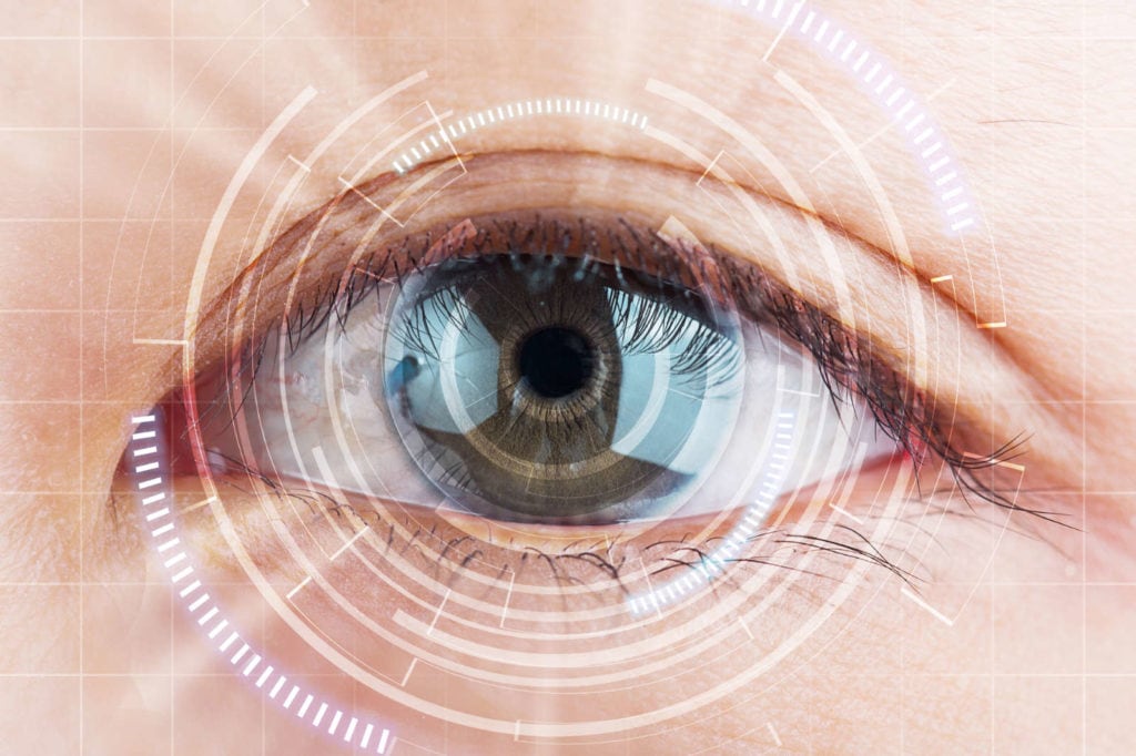 lens replacement surgery