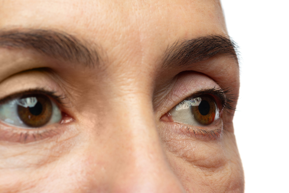 How to treat achy eyes